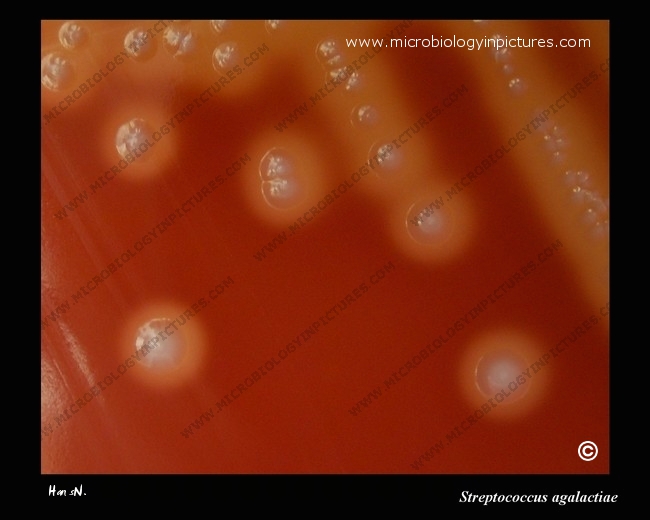 s.agalactiae colonies on agar